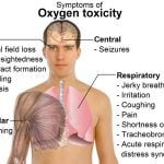 oxygen toxicity symptoms