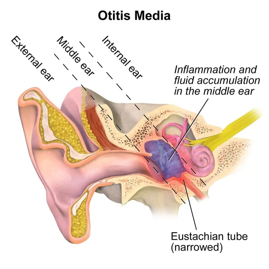 Problems with equalizing when diving. Eustachian tube blockage. Human ear anatomy picture