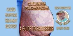 Skin Bends: A Guide to Cutaneous Decompression Sickness skin-bends-guide-to-cutaneous-DCS